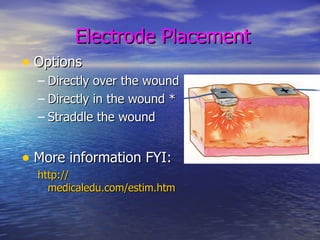Electrode Placement Options Directly over the wound Directly in the wound * Straddle the wound More information FYI: http:// medicaledu.com/estim.htm 