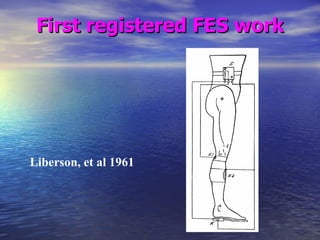 First registered FES work Liberson, et al 1961 
