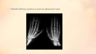 • Osteitis fibrosa cystica is seen in advanced cases
 