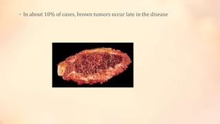 • In about 10% of cases, brown tumors occur late in the disease
 