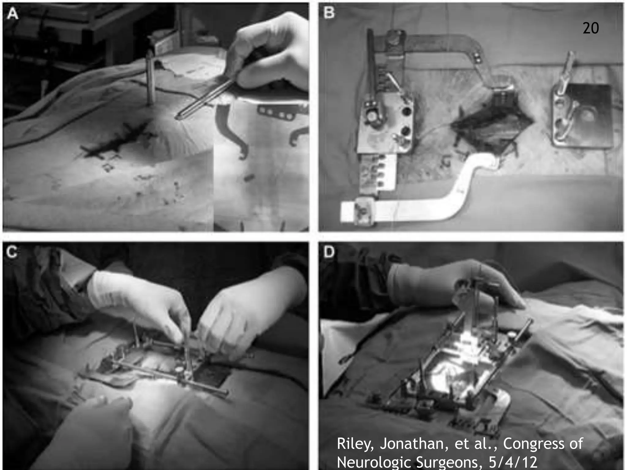20 
Riley, Jonathan, et al., Congress of 
Neurologic Surgeons, 5/4/12 
 
