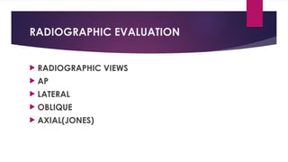 RADIOGRAPHIC EVALUATION
 RADIOGRAPHIC VIEWS
 AP
 LATERAL
 OBLIQUE
 AXIAL(JONES)
 
