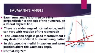 BAUMANN’S ANGLE
 Baumann’s angle is formed by a line
perpendicular to the axis of the humerus, and
a lateral physeal line
 There is a wide range of normal value, and it
can vary with rotation of the radiograph
 The Baumann angle is good measurement of
any deviation of distal humerus`s angulation
 In this case, the medial impaction and varus
position alters the Bauman’s angle.
 Normal avg 72 *
 