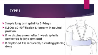 TYPE I
 Simple long arm splint for 3-7days
 ELBOW 60-90 flexion & forearm in neutral
⁰
position
 If no displacement after 1 week splint is
converted to long arm cast
 If displaced # is reduced f/b casting/pinning
done
 
