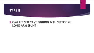 TYPE II
 CMR F/B SELECTIVE PINNING WITH SUPPOTIVE
LONG ARM SPLINT
 