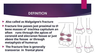 DEFINITION
 Also called as Malgaigne’s fracture
 Fracture line passes just proximal to the
bone masses of trochlea capitulum and
often runs through the apices of
coronoid and olecranon fossae or just
above the fossae or through
metaphysis of humerus
 The fracture line is generally
transverse in frontal plane
 