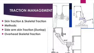 TRACTION MANAGEMENT
 Skin Traction & Skeletal Traction
 Methods:
 Side arm skin Traction (Dunlop)
 Overhead Skeletal Traction
 