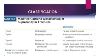 CLASSIFICATION
 