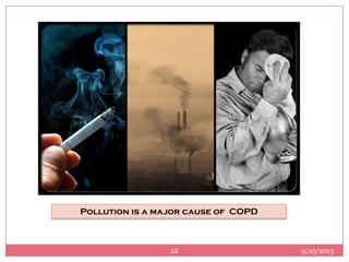 Pollution is a major cause of COPD
9/25/201312
 