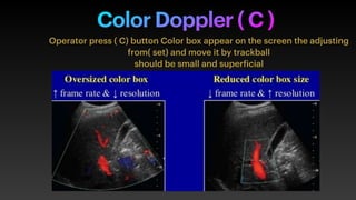 Presentation 2 DOPPLER.pdf