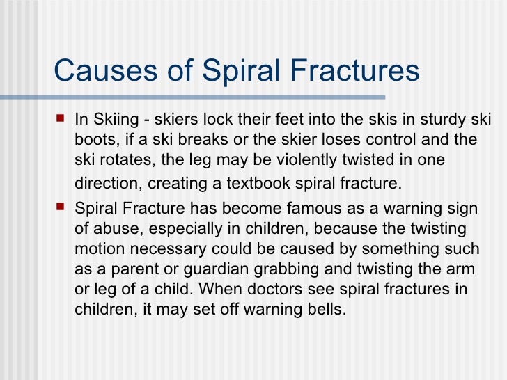 spiral fracture causes spiral fracture causes