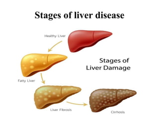 Stages of liver disease
 