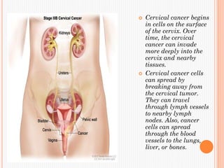  Cervical cancer begins
in cells on the surface
of the cervix. Over
time, the cervical
cancer can invade
more deeply into the
cervix and nearby
tissues.
 Cervical cancer cells
can spread by
breaking away from
the cervical tumor.
They can travel
through lymph vessels
to nearby lymph
nodes. Also, cancer
cells can spread
through the blood
vessels to the lungs,
liver, or bones.
 