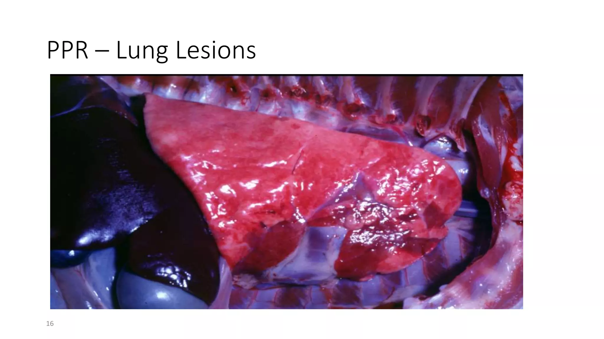 16
PPR – Lung Lesions
 