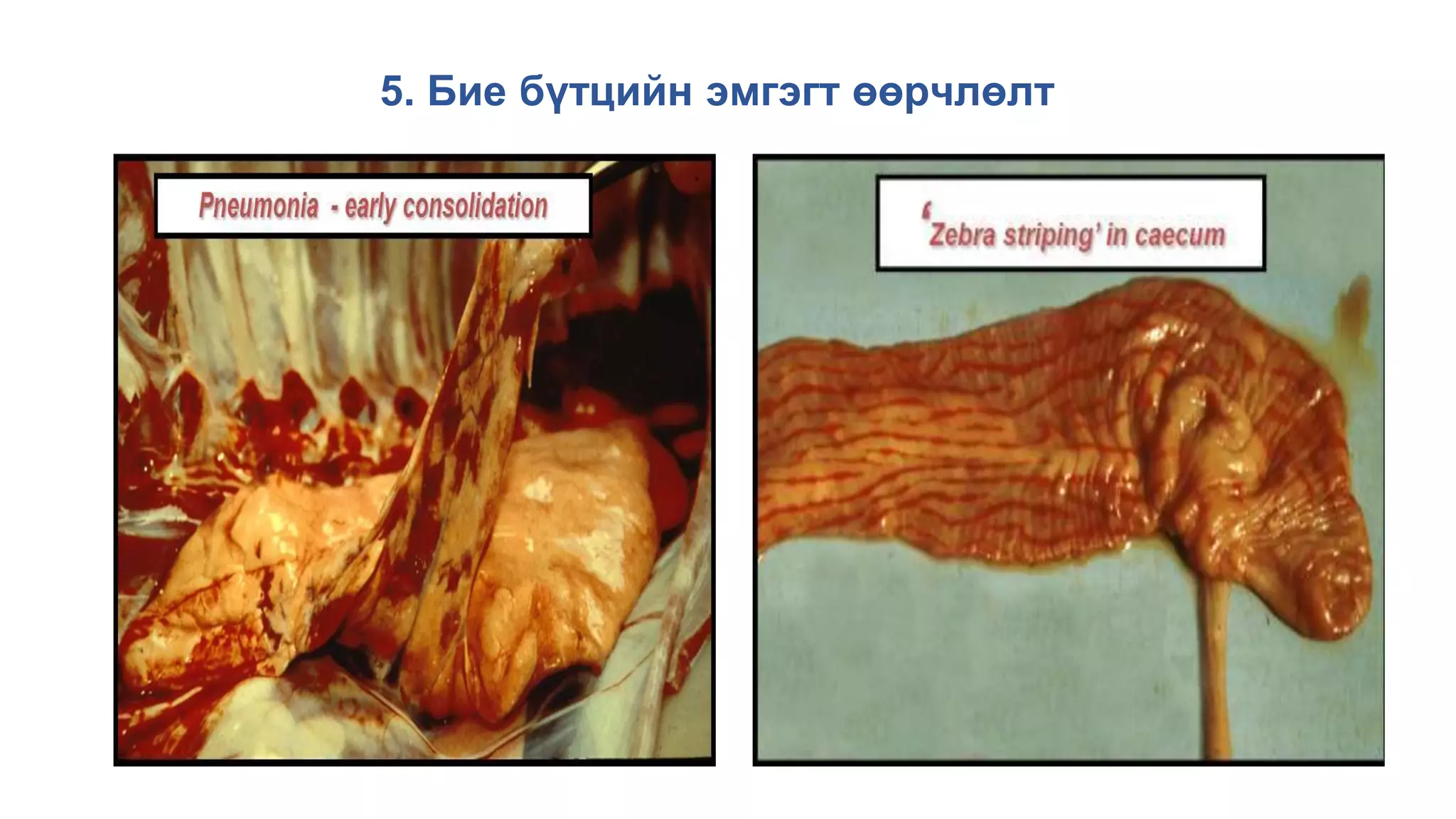 5. Бие бүтцийн эмгэгт өөрчлөлт
 