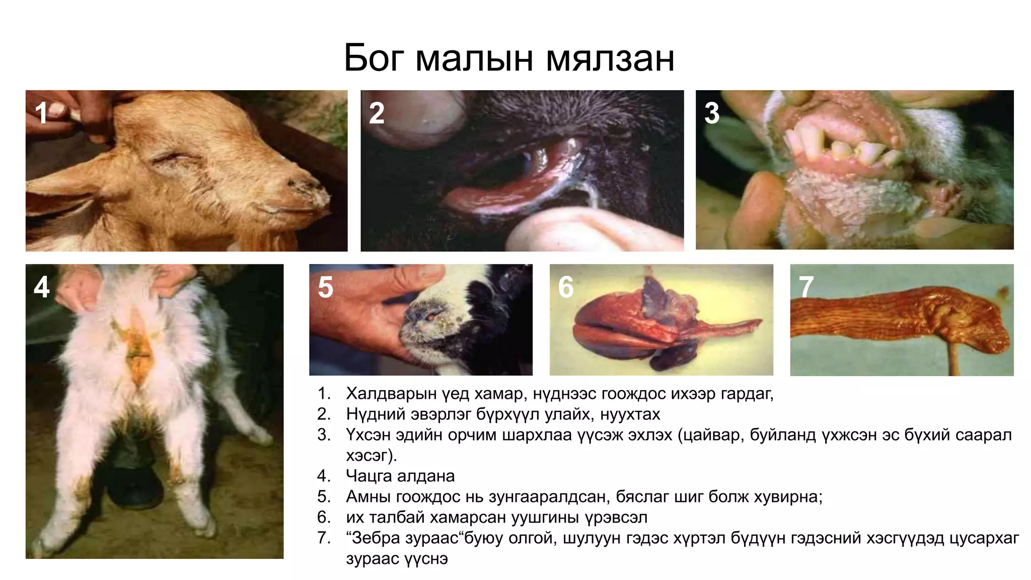 1. Халдварын үед хамар, нүднээс гоождос ихээр гардаг,
2. Нүдний эвэрлэг бүрхүүл улайх, нуухтах
3. Үхсэн эдийн орчим шархлаа үүсэж эхлэх (цайвар, буйланд үхжсэн эс бүхий саарал
хэсэг).
4. Чацга алдана
5. Амны гоождос нь зунгааралдсан, бяслаг шиг болж хувирна;
6. их талбай хамарсан уушгины үрэвсэл
7. “Зебра зураас“буюу олгой, шулуун гэдэс хүртэл бүдүүн гэдэсний хэсгүүдэд цусархаг
зураас үүснэ
1 2
7654
3
Бог малын мялзан
 