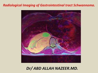Radiological Imaging of Gastrointestinal tract Schwannoma.
Dr/ ABD ALLAH NAZEER.MD.
 
