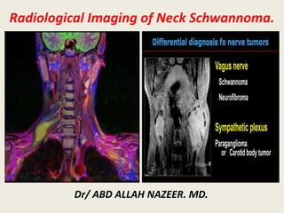 Radiological Imaging of Neck Schwannoma.
Dr/ ABD ALLAH NAZEER. MD.
 