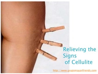    Relieving the Signs
    of Cellulite




                             Relieving the
                             Signs
                              of Cellulite
                      http://www.grupomayanfriends.com
 
