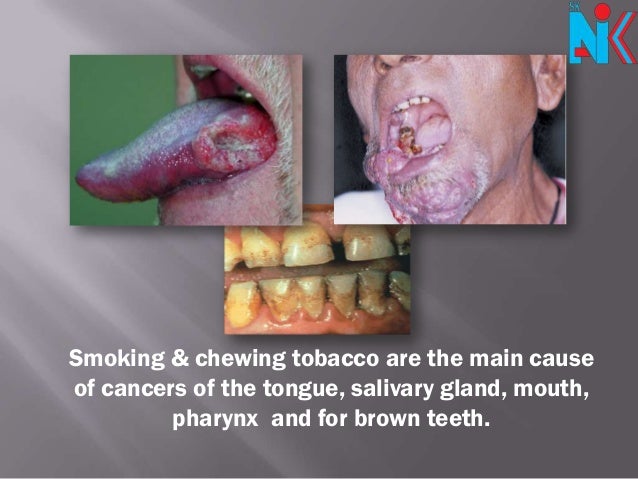 the features of smokeless tobacco and its effects Tobacco use harms every organ in the body and can cause many problems the health effects of smokeless tobacco are somewhat different from those of smoked tobacco, but both can cause cancer tobacco, nicotine, & e-cigarettes retrieved from https. the features of smokeless tobacco and its effects Tobacco use harms every organ in the body and can cause many problems the health effects of smokeless tobacco are somewhat different from those of smoked tobacco, but both can cause cancer tobacco, nicotine, & e-cigarettes retrieved from https.