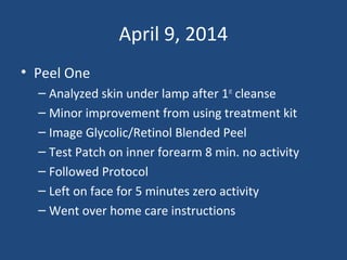 April 9, 2014
• Peel One
– Analyzed skin under lamp after 1st
cleanse
– Minor improvement from using treatment kit
– Image Glycolic/Retinol Blended Peel
– Test Patch on inner forearm 8 min. no activity
– Followed Protocol
– Left on face for 5 minutes zero activity
– Went over home care instructions
 