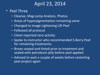 April 23, 2014
• Peel Three
– Cleanse, Mag-Lamp Analysis, Photos.
– Areas of hyperpigmentation remaining same
– Changed to Image Lightening Lift Peel
– Followed all protocol
– Client reported zero activity
– Spoke to instructor who recommended 5-Berry Peel
for remaining treatments.
– Brows waxed and tinted prior to treatment and
sealed with petroleum jelly before peel applied
– Advised to wait a couple of weeks before restarting
peel project again
 