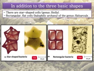 In addition to the three basic shapes 
- There are star-shaped cells (genus Stella). 
- Rectangular, flat cells (halophilic archaea) of the genus Haloarcula . 
Star-shaped bacteria Rectangular bacteria 
 