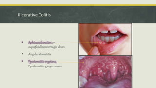Oral Cavity is the Mirror Image of Body | PPTX