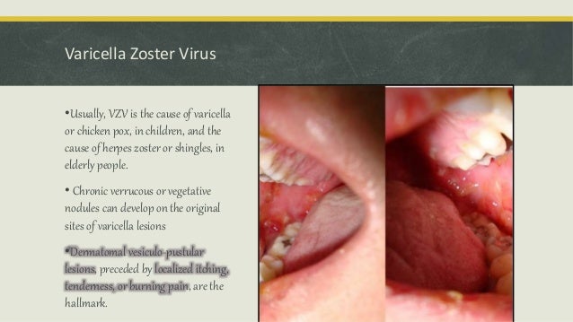 Oral Cavity Is The Mirror Image Of Body