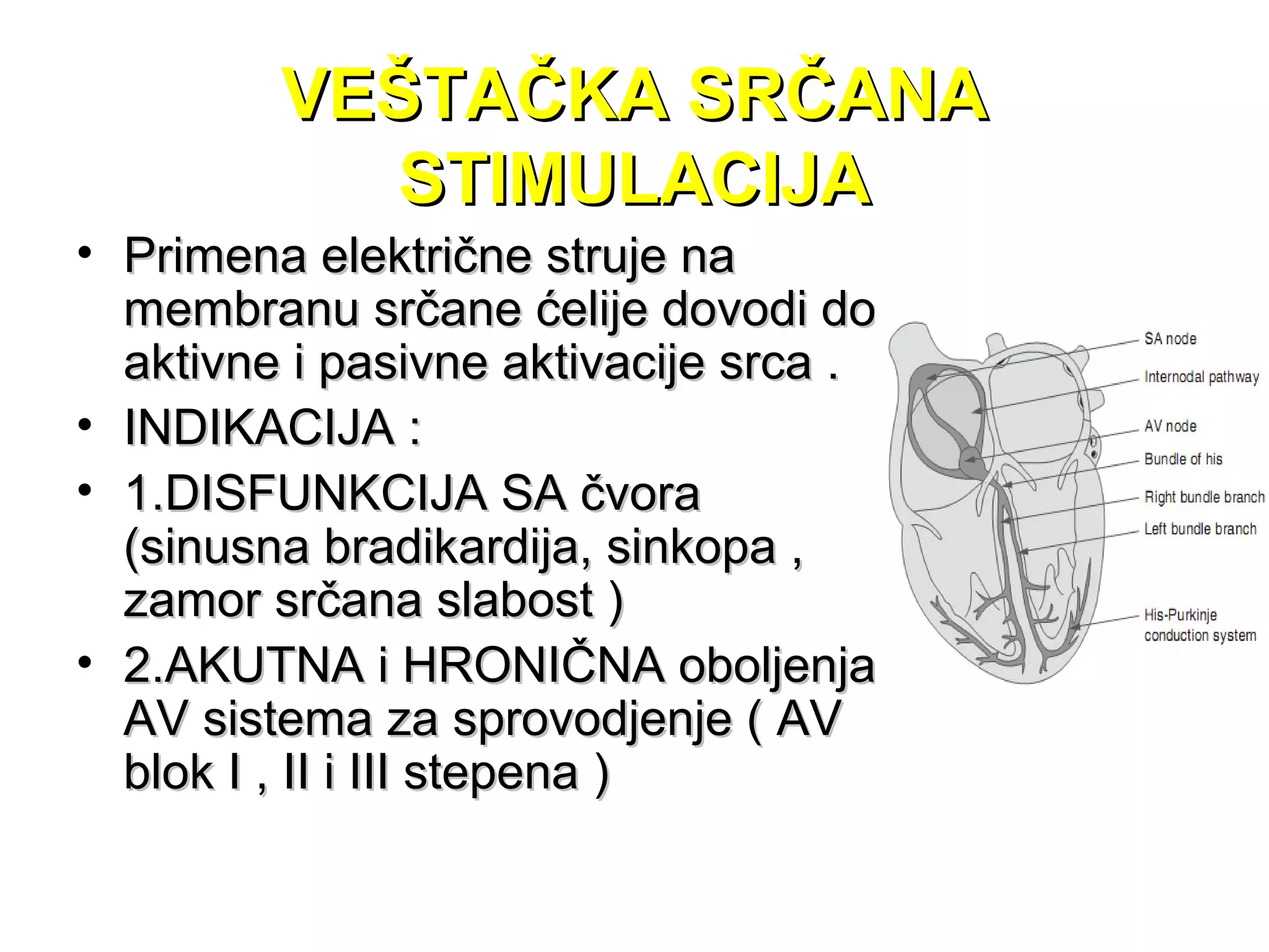 VEŠTAČKA SRČANAVEŠTAČKA SRČANA
STIMULACIJASTIMULACIJA
• Primena električne struje naPrimena električne struje na
membranu srčane ćelije dovodi domembranu srčane ćelije dovodi do
aktivne i pasivne aktivacije srca .aktivne i pasivne aktivacije srca .
• INDIKACIJA :INDIKACIJA :
• 1.DISFUNKCIJA SA čvora1.DISFUNKCIJA SA čvora
(sinusna bradikardija, sinkopa ,(sinusna bradikardija, sinkopa ,
zamor srčana slabost )zamor srčana slabost )
• 2.AKUTNA i HRONIČNA oboljenja2.AKUTNA i HRONIČNA oboljenja
AV sistema za sprovodjenje ( AVAV sistema za sprovodjenje ( AV
blok I , II i III stepena )blok I , II i III stepena )
 