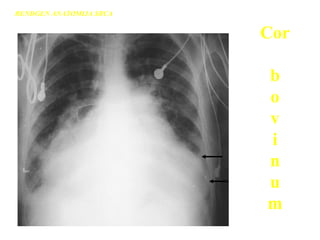 Cor
b
o
v
i
n
u
m
RENDGEN ANATOMIJA SRCA
 