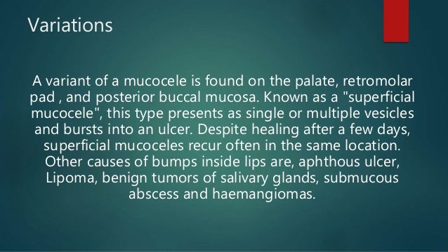mucocele