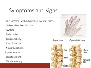 Symptoms and signs:
- Pain increases with activity and worse at night.
- Stiffness less than 30 mins.
- Swelling
- Deformities
- Joint instability
- Loss of function
- Neurological signs
if spine Involved.
- Crepitus Sound
- Muscle wasting
 