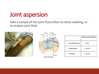 Joint aspersion
Take a sample of the joint fluid either to relive swelling, or
to analyze joint fluid
 