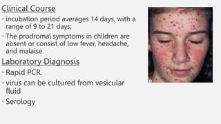 Clinical Course
• incubation period averages 14 days, with a
range of 9 to 21 days;
• The prodromal symptoms in children are
absent or consist of low fever, headache,
and malaise
Laboratory Diagnosis
• Rapid PCR.
• virus can be cultured from vesicular
fluid
• Serology
 