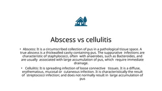 Mandibular space infections Presentation3.pptx