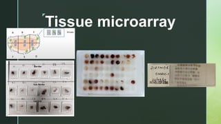 TISSUE MICROAARAY IN HISTOPATHOLOGY TECNIQUES | PPTX