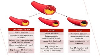 Comprehensive Overview of Acute Coronary Syndromes: Diagnosis and ...