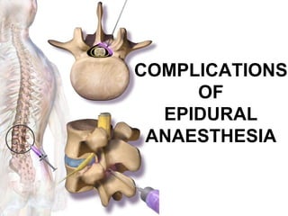 COMPLICATIONS OF SPINAL & EPIDURAL ANAESTHESIA | PPTX