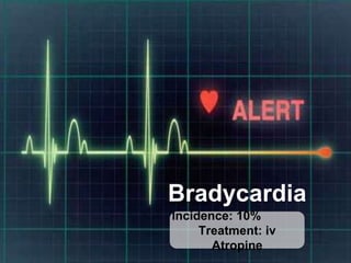 complications epidural anaesthesia