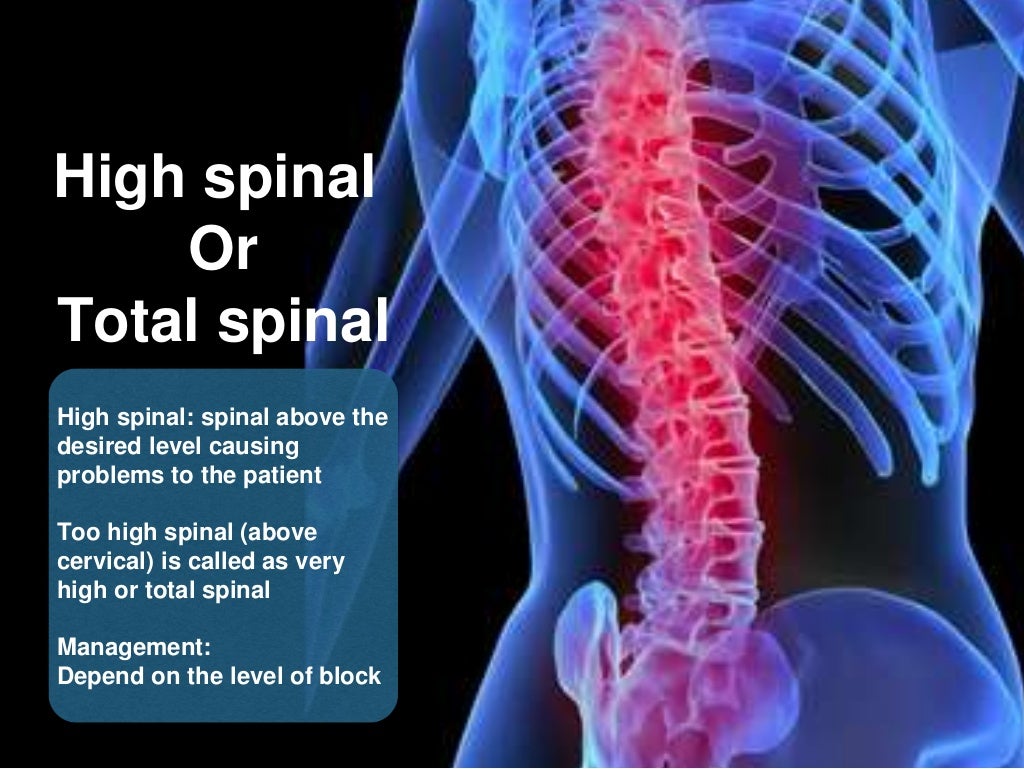 COMPLICATIONS OF SPINAL & EPIDURAL ANAESTHESIA