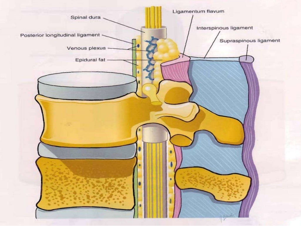 COMPLICATIONS OF SPINAL & EPIDURAL ANAESTHESIA