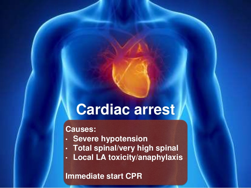 COMPLICATIONS OF SPINAL & EPIDURAL ANAESTHESIA