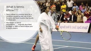 What is tennis
elbow???
• Tennis elbow is a common term for a
condition caused by over use of arm,
forearm, and hand muscles that results
in elbow pain.
• Also known as lateral
epicondylitis...... originally described
by Major in 1883 as lateral elbow pain
in tennis players.
 