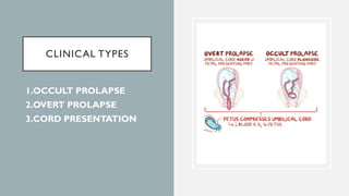 CLINICAL TYPES
1.OCCULT PROLAPSE
2.OVERT PROLAPSE
3.CORD PRESENTATION
 
