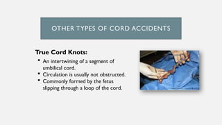 OTHER TYPES OF CORD ACCIDENTS
True Cord Knots:
 An intertwining of a segment of
umbilical cord.
 Circulation is usually not obstructed.
 Commonly formed by the fetus
slipping through a loop of the cord.
 