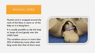 NUCHAL CORD
Nuchal cord is wrapped around the
neck of the fetus in utero or of the
baby as it is being born.
It is usually possible to slip the loop
or loops of cord gently over the
child’s head.
The condition occurs in more than
25% of deliveries, more often with
long cords than that of short ones.
 