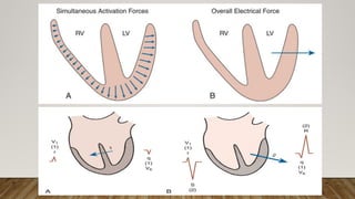 Comprehensive Introduction to Electrocardiogram (ECG) Interpretation ...