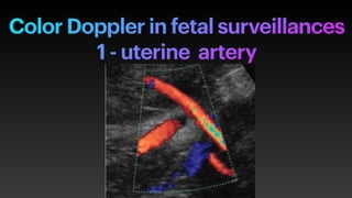 Color Doppler in fetal surveillances


1 - uterine artery
 
