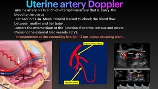 Presentation 3 uterine artery doppler .pdf